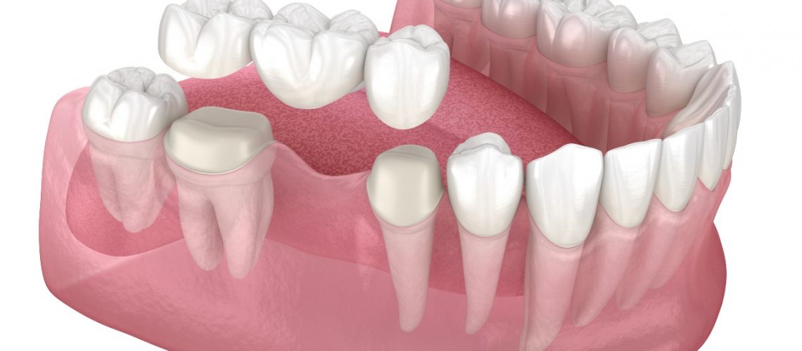 when to see dentist for gum pain